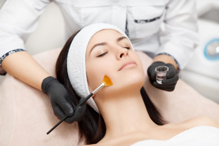 chemical peeling adalah