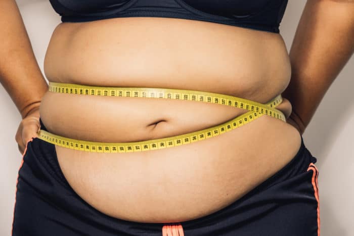 obesitas