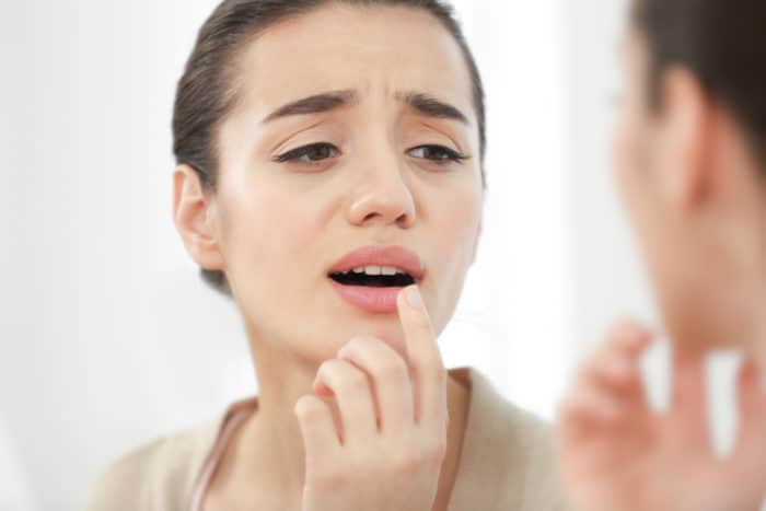 bibir terasa panas