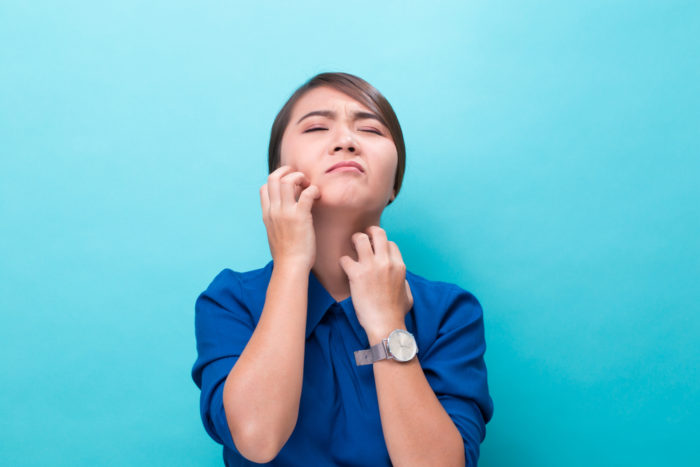 alergi benzoil peroksida kulit kering gatal