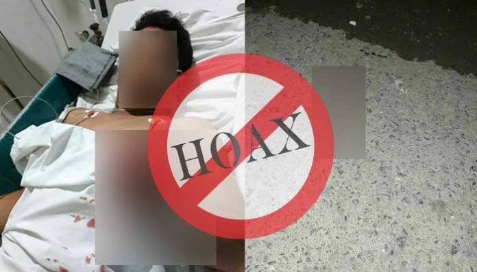 [BENAR] KEPOLISIAN MEDAN ANGKAT BICARA TERKAIT FOTO KORBAN BEGAL YANG ALAMI PUTUS TANGAN