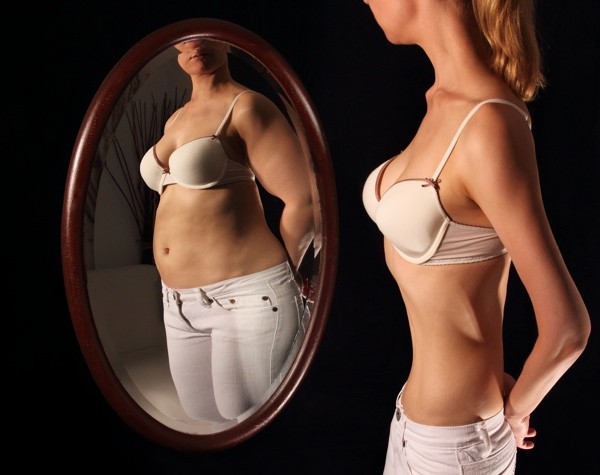 anoreksia dan bulimia