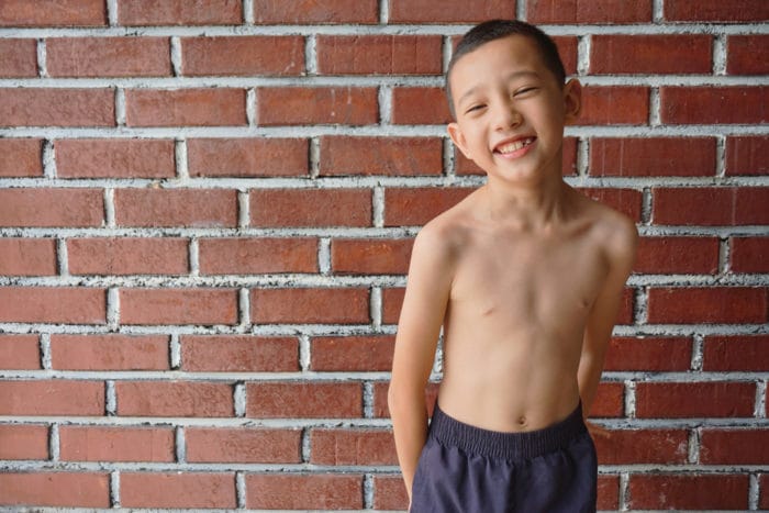 anak kurus