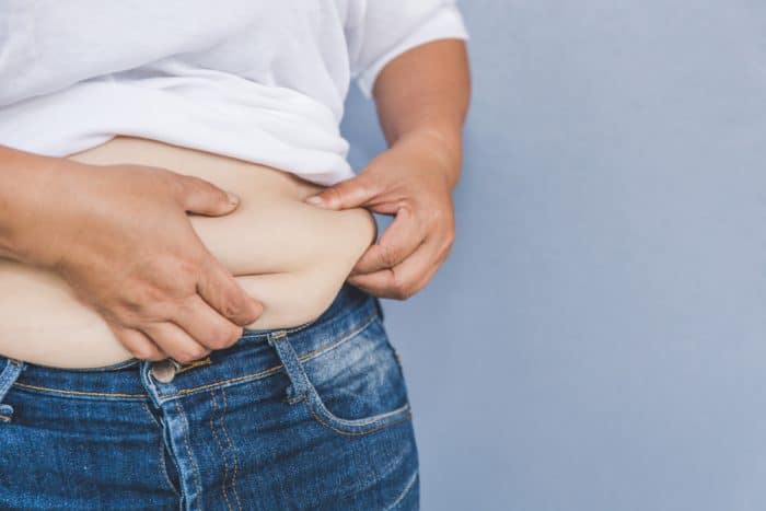 berat badan berlebihan obesitas berisiko varises