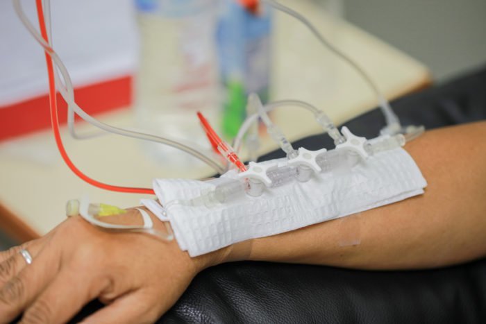 kemoterapi, obat kanker pada pasien obesitas