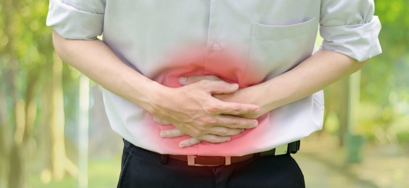 Kanker kolorektal adalah istilah yang digunakan untuk menyebut kanker yang bermula dari usus besar hingga rektum (anus). Kanker ini juga bisa disebut sebagai kanker usus besar atau kanker rektum secara terpisah, tergantung pada lokasi bermulanya kanker. Apa dampaknya memiliki kanker usus besar pada kesehatan sistem pencernaan? Begini penjelasannya. Cara kerja sistem pencernaan tubuh yang normal Usus besar dan rektum adalah bagian dari sistem pencernaan. Bagian pertama dari sistem pencernaan (lambung dan usus halus) memproses makanan sebagai energi, sementara bagian terakhir (usus besar dan rektum) menyerap cairan untuk membentuk kotoran padat yang kemudian dikeluarkan dari tubuh. Setelah dikunyah dan ditelan, makanan bergerak dari kerongkongan menuju lambung. Di sinilah makanan sebagian diuraikan dan kemudian dikirim ke usus halus, atau disebut juga usus kecil. Usus ini disebut kecil karena lebih sempit daripada usus besar (kolon dan rektum), tetapi usus halus sebenarnya merupakan bagian terpanjang dari sistem pencernaan — dengan panjang sekitar 6 meter. Usus halus berfungsi untuk melanjutkan penguraian makanan dan menyerap sebagian besar nutrisi, yang kemudian diedarkan ke seluruh tubuh. Usus halus menyambung ke usus besar di perut kanan bawah. Sebagian besar usus besar terdiri dari saluran berotot dengan panjang sekitar 1,5 meter. Kolon menyerap air dan garam dari zat sisa makanan dan berfungsi sebagai tempat penyimpanan residu kotoran. anatomi usus besar (sumber: WebMD) Usus besar (kolon) memiliki 4 bagian: Bagian pertama disebut kolon asenden. Bagian ini dimulai dengan kantung kecil (sekum) di mana usus halus tersambung dengan kolon dan memanjang ke atas di sisi perut kanan. Sekum juga merupakan tempat di mana usus buntu tersambung ke kolon. Bagian kedua disebut kolon transversum karena membentang dari sisi kanan ke kiri perut atas. Bagian ketiga, disebut kolon desenden, terus memanjang ke bawah di sisi kiri. Bagian keempat, dan yang terakhir, disebut kolon sigmoid karena bentuknya yang menyerupai huruf “S” atau “sigmoid.” Zat sisa makanan yang tersisa setelah melewati kolon disebut feses atau tinja. Kotoran ini diangkut dan disimpan di rektum, di 15 cm terakhir dari sistem pencernaan sampai waktunya dikeluarkan dari tubuh lewat anus. Dinding usus besar dan rektum terbentuk dari beberapa lapisan. Kanker kolorektal dimulai di lapisan terdalam dan bisa tumbuh melalui sebagian atau semua lapisan lainnya. Tingkat penyebaran kanker usus besar akan bergantung pada seberapa dalam kanker bertumbuh ke dalam lapisan-lapisan ini. Perkembangan kanker usus besar dalam tubuh Kebanyakan kanker usus besar berkembang perlahan selama beberapa tahun. Sebelum kanker berkembang, pertumbuhan jaringan atau tumor biasanya dimulai sebagai polip non-kanker pada dinding dalam usus besar atau rektum. Tahap perkembangan kanker usus besar (Ki-ka: polip kolon jinak hingga jadi tumor kanker) sumber: askdoctork.com Tumor adalah jaringan abnormal dan bisa bersifat jinak (bukan kanker) atau ganas (kanker). Polip adalah tumor non-kanker yang jinak. Beberapa polip bisa berubah menjadi kanker, tetapi tidak semuanya. Kemungkinan berubahnya polip menjadi kanker bergantung pada jenis polip itu sendiri. Ada dua jenis utama dari polip: Polip adenomatosa/adenoma (Gambar kedua dari kiri) adalah polip yang bisa berubah menjadi kanker. Oleh karena itu, adenoma disebut sebagai kondisi pra-kanker. Polip hiperplastik dan polip inflamasi, secara umum, bukanlah pra-kanker. Namun, beberapa dokter berpikir bahwa beberapa polip hiperplastik bisa menjadi pra-kanker atau bisa menjadi tanda peningkatan risiko terkena adenoma dan kanker, terutama jika polip ini tumbuh di kolon asenden. Jenis kondisi pra-kanker lainnya disebut displasia (gambar keempat dari kiri dari ilustrasi di atas). Displasia adalah area di dinding usus besar atau rektum di mana sel terlihat abnormal, tetapi tidak seperti sel kanker yang sesungguhnya, saat dilihat dengan mikroskop. Sel-sel ini bisa berubah menjadi kanker seiring waktu. Displasia biasanya ditemukan pada orang yang pernah terkena penyakit seperti kolitis ulseratif atau penyakit Crohn selama bertahun-tahun. Baik kolitis ulseratif dan penyakit Crohn menyebabkan peradangan kronis pada usus besar. Jika terbentuk polip, kanker pada akhirnya bisa mulai berkembang masuk ke dalam dinding usus besar atau rektum. Saat berada di dinding, sel-sel kanker kemudian bisa merasuk ke dalam pembuluh darah atau pembuluh getah bening. Pembuluh getah bening adalah saluran tipis dan kecil yang mengangkut kotoran dan cairan. Saluran-saluran ini pertama mengalir ke kelenjar getah bening, yaitu struktur berbentuk kacang yang mengandung sel-sel imun yang membantu melawan infeksi. Begitu menyebar ke dalam pembuluh darah atau pembuluh getah bening, sel-sel kanker bisa bergerak ke kelenjar getah bening terdekat atau bagian lain yang jauh di tubuh, seperti hati. Saat kanker menyebar ke bagian yang jauh di tubuh, ini disebut metastasis. Macam-macam jenis kanker usus besar Beberapa jenis kanker bisa dimulai di usus besar atau rektum, contohnya: Adenokarsinoma Lebih dari 95% kanker kolorektal adalah jenis kanker adenokarsinoma. Kanker ini dimulai di sel-sel yang membentuk kelenjar penghasil lendir untuk melumasi dinding dalam usus besar dan rektum. Saat dokter berbicara tentang kanker usus besar, inilah yang hampir selalu mereka maksudkan. Tumor karsinoid Tumor ini dimulai dari sel-sel penghasil hormon khusus di usus. Tumor stroma gastrointestinal (GIST) Tumor ini dimulai dari sel-sel khusus di dinding usus besar yang disebut sel interstisial dari Cajal. Beberapa bersifat jinak (non-kanker), dan lainnya bersifat ganas (kanker). Tumor ini bisa terdapat di setiap bagian sistem pencernaan, tetapi jarang ditemukan di usus besar. Limfoma Limfoma adalah jenis kanker yang memengaruhi sel sistem kekebalan tubuh, yang biasanya dimulai di kelenjar getah bening. Limfoma juga bisa dimulai di usus besar, rektum, atau organ lainnya. Sarkoma Sarkoma adalah jenis tumor yang bisa dimulai di pembuluh darah, otot, dan jaringan ikat pada dinding usus besar dan rektum. Sarkoma usus besar atau sarkoma rektum merupakan jenis kanker langka.