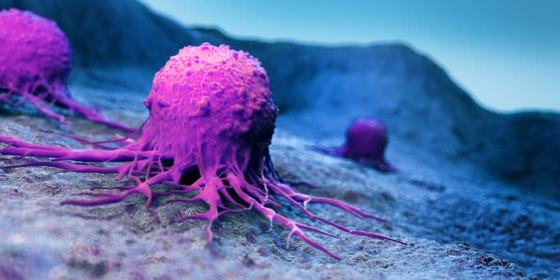 metastasis kanker