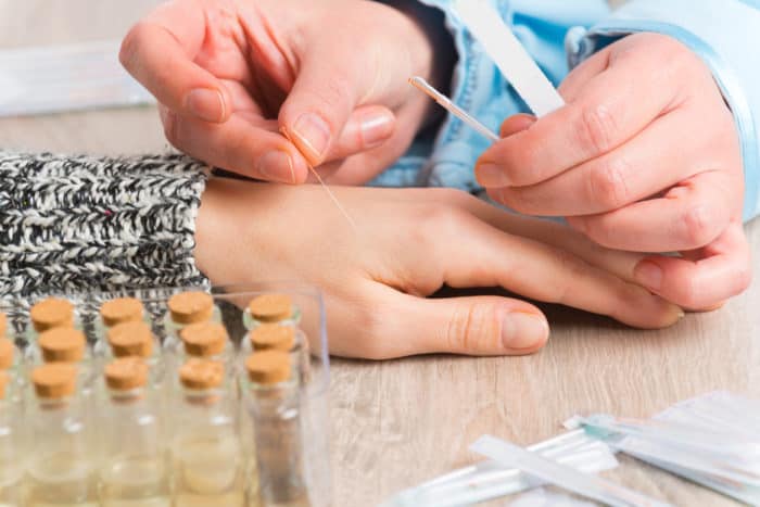 akupunktur untuk diabetes