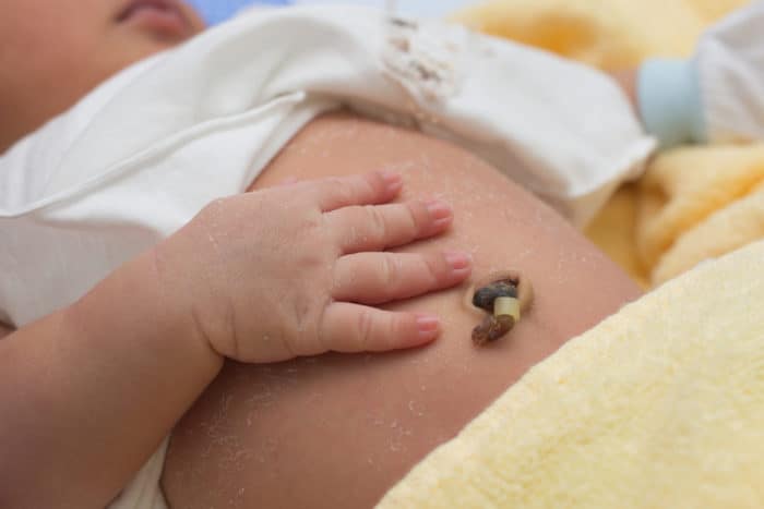 simpan tali pusat bayi