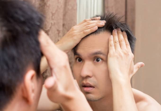 penyebab kerutan pada wajah pria
