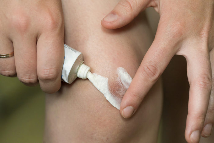 Diflorasone adalah obat
