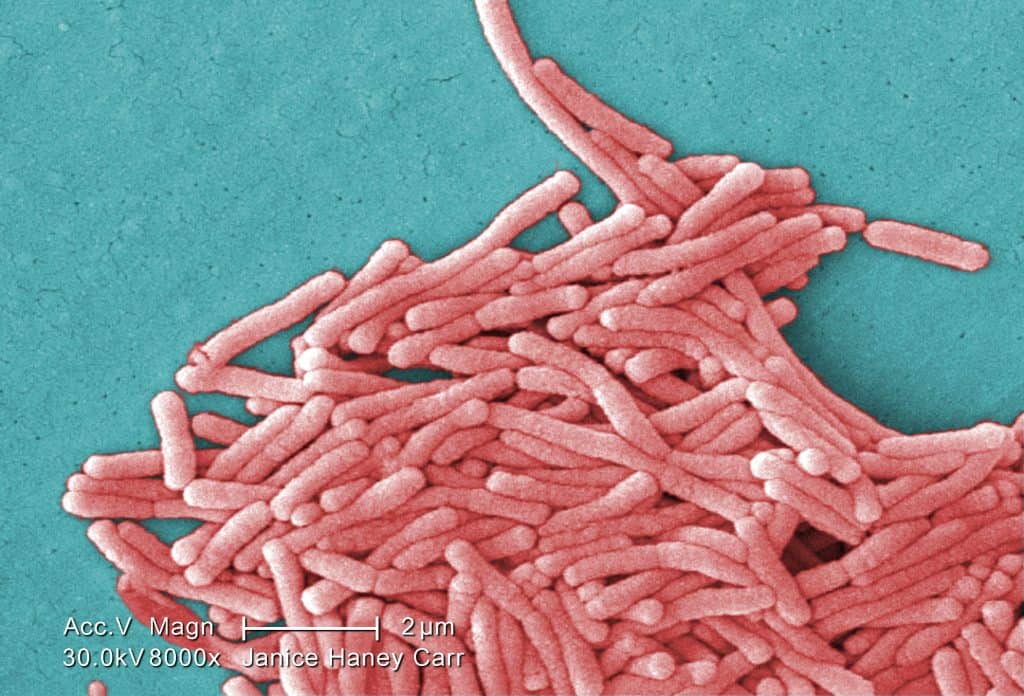 bakteri legionella