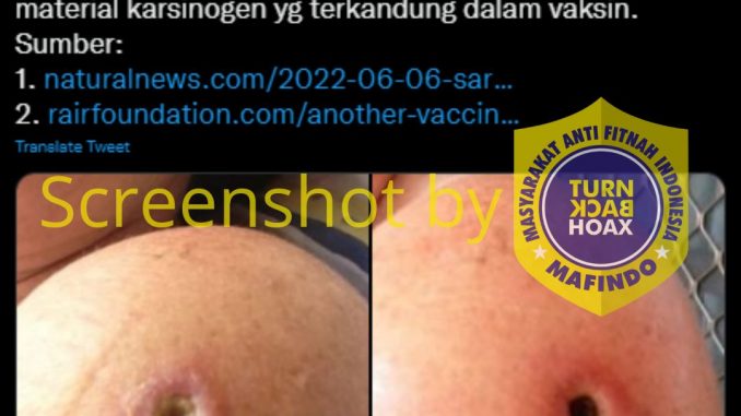 [SALAH] Vaksin Covid-19 Menyebabkan Peningkatan Kasus Kanker